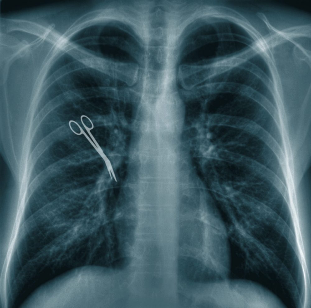 X-ray,Chest,Image,With,Scissors